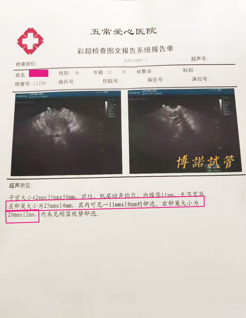澳洲代孕妈妈.jpg