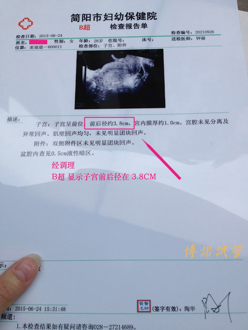 澳洲代孕费用.jpg