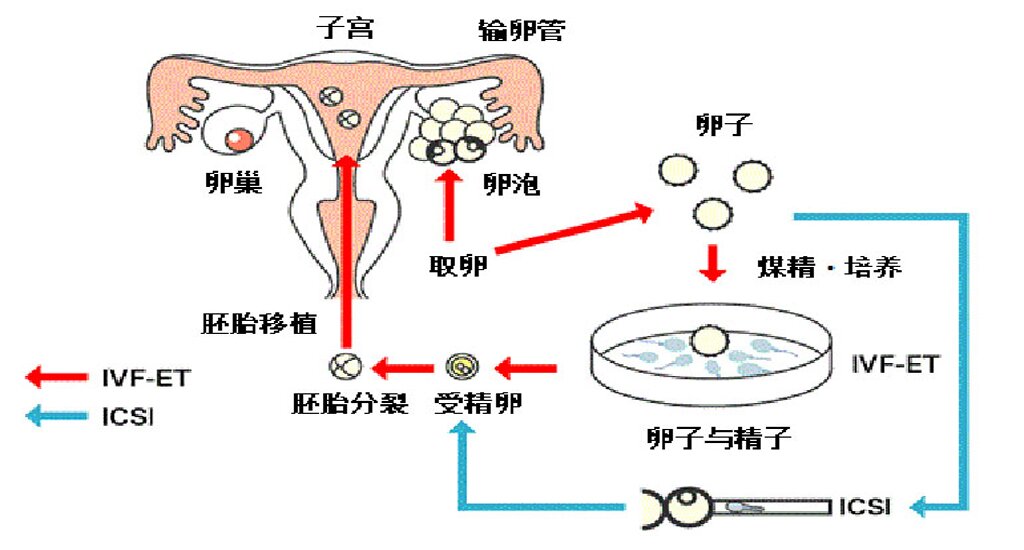 澳洲代孕机构：我的“幸孕”不是“奇迹”